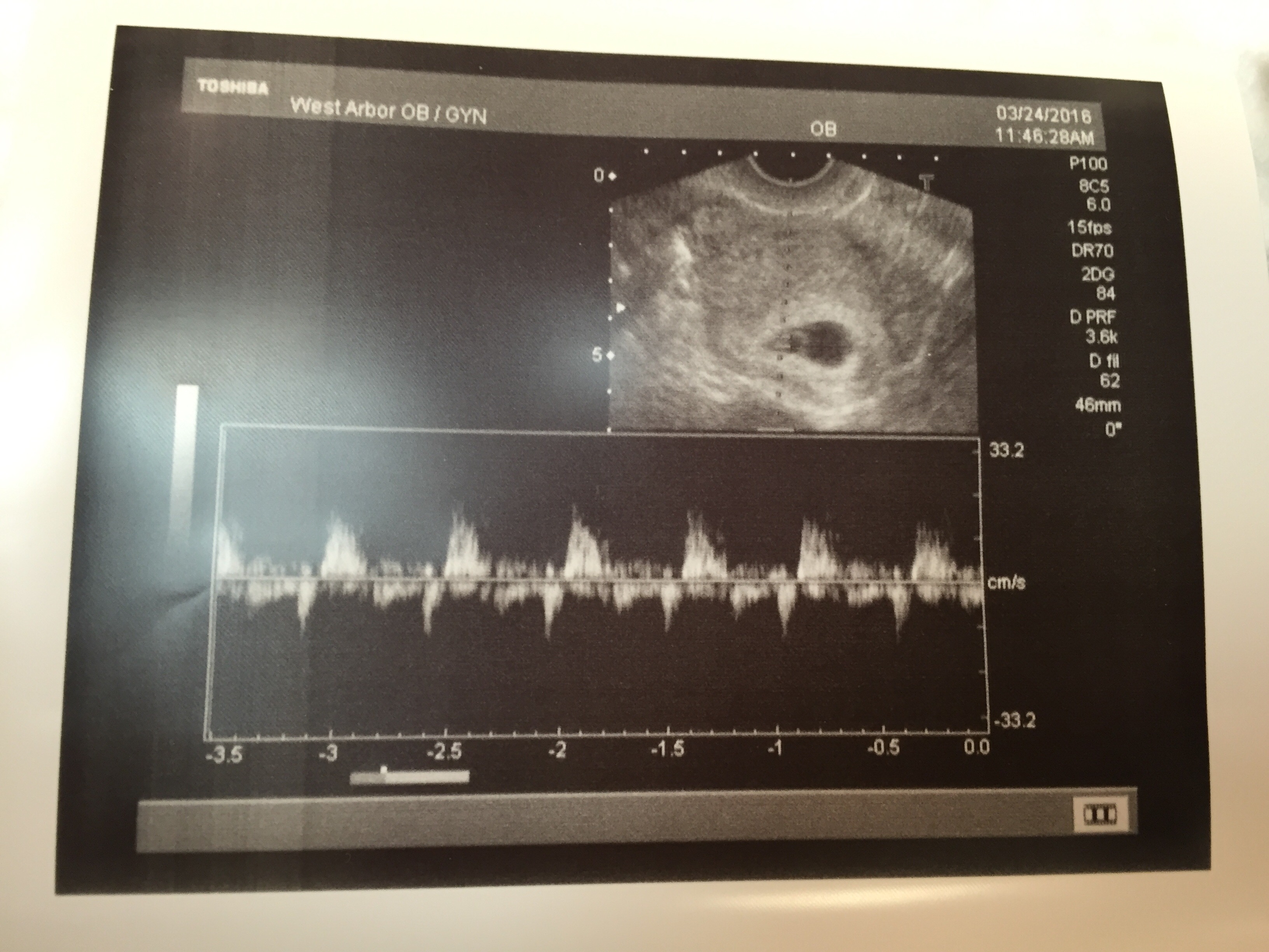 Heartbeat_ReadySetSarahBlog